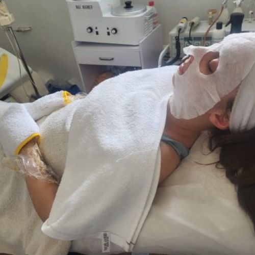 Tratamiento de ácido hialurónico